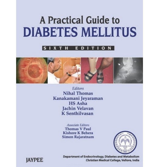 A Practical Guide to Diabetes Mellitus, 6th Edition